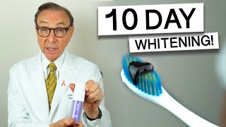 Hismile Purple Toothpaste for 10 Days  Dentist Review teethwhitening [upl. by Nnylamme436]