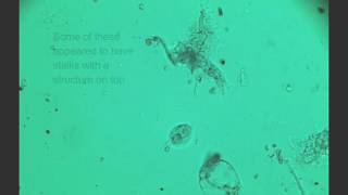 amoeba dictyostelium spore release [upl. by Nalyd]