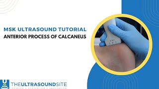 MSK ultrasound evaluation on how to find the anterior process of the calcaneus [upl. by Berkie125]