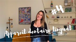 Ma chirurgie Maxillofaciale  Vlog 4  bilan appareil dentaire lingual après 1 semaine [upl. by Sigfrid]