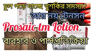 খুশকি ও চুলপড়ার অন্যতম ঔষধprosalic lotion usesprosalic lotion bangla reviewmedicine knowledge bd [upl. by Nevur]