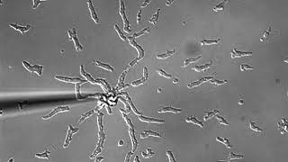 Dictyostelium chemotaxis to cAMP [upl. by Zamir]