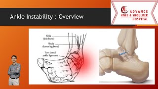 Ankle Instability  approach Diagnosis and Treatment including internal brace [upl. by Boesch]