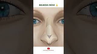 BULBOUS NOSE 👃  Cosmetic Surgery [upl. by Ajam]