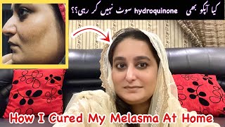 How To Remove Melasma amp Hyperpigmentation At HomeAzelic Acid For Melasma amp Hyperpigmentation [upl. by Mccurdy547]