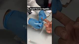 Syphilis Rapid test performance lab technician status status shorts vldl syphilis lab blood [upl. by Malliw]