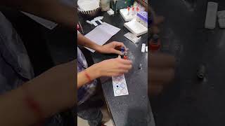 Lab par widal test minivlog lab shorts [upl. by Acinet]