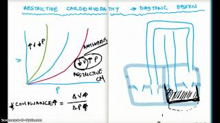 Restrictive Cardiomyopathy and Diastolic Dysfunction [upl. by Itraa]