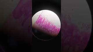 Histological slide of tongue showing filiform and fungiform papillae [upl. by Ambrogio647]