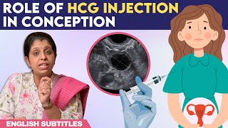 Role Of hCG Injection In Conception  hCG ஊசி செலுத்திய பிறகு கரு முட்டை எப்போது வெளிவரும் [upl. by Colyer]