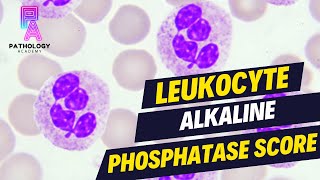 LAP SCORE Leukocyte Alkaline Phosphatase Score  By Dr Aditi Kumar [upl. by Longley]