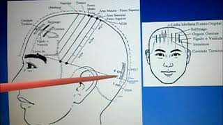 VG20 Parte 7 Neurologia e Craniopuntura de Jiao Shun Fa [upl. by Evilo]