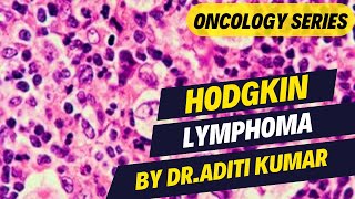 HODGKIN LYMPHOMA [upl. by Tutt]