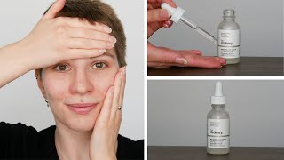 How to use The Ordinary Niacinamide 10  Zinc 1  Full Demonstration [upl. by Seuqramed]