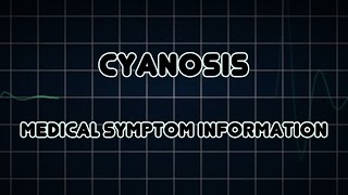 Cyanosis Medical Symptom [upl. by Enytnoel]