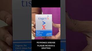 Peyronie’s disease treatment  plaque incision with grafting peyroniesdisease [upl. by Tloc]