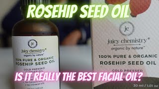 Juicy chemistry Rosehip Seed oil review  Best Facial Oil for oily skin [upl. by Akimit137]