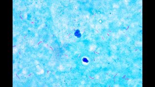 Mycobacterium under microscope afb positive [upl. by Murphy]