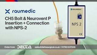 Parenchymal ICP measurement via NPS2 connection to Neurovent P inc CH5 Bolt Insertion  July 2024 [upl. by Bronk]