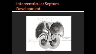 Interventricular Septum Development [upl. by Siladnerb]