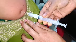 Arm injection IM Soma Ject Injection Push √√ Injection Video জন্মবিরতিকরণ ইনজেকশন 24 Ep 53 [upl. by Muhcan]