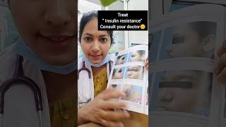 Read the description drdivya doctor drdivyat acanthosisnigricans darkneck healthtipinkannada [upl. by Wendt]