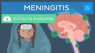 Meningitis Hirnhautentzündung Ursachen Symptome Behandlung  Kenhub [upl. by Ahsinyt]