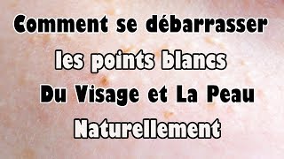 Comment se débarrasser les points blancs Du Visage et La Peau Naturellement [upl. by Rialc]