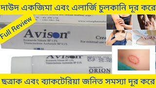 Avison Cream দাউদ একজিমা এবং চুলকানি ভালো করার ঔষধ সম্পর্কে বিস্তারিত আলোচনা [upl. by Aicilra]