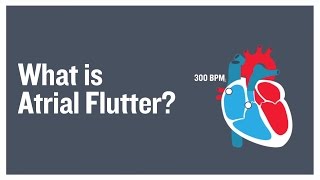 What is atrial flutter [upl. by Illak]