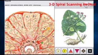 Diagnosis and Therapy Metapathia Hunter MEDICOMAT4025 [upl. by Eckblad]