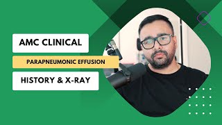 AMC Clinical Exam Parapneumonic Effusion [upl. by Essirahs]