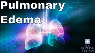 Flash Pulmonary Edema Emergency [upl. by Imaon]