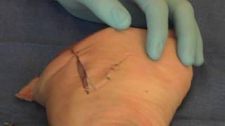 Suture  Dog Ear [upl. by Leverick]