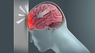 How Traumatic Brain Injury TBI Affects Brain Cells  New Research Could Lead to New Treatments [upl. by Culbert]