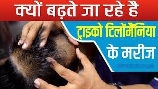 What is Trichotillomania Treatment of Trichotillomania Hair Pulling Disorder By Dr Mukesh [upl. by Leamsi786]