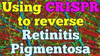 Using CRISPR to reverse retinitis pigmentosa and restore visual function  QPT [upl. by Gnad]