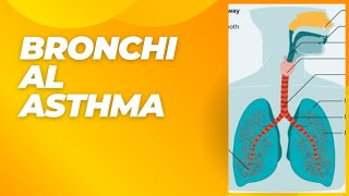 TOPIC15quotBRONCHIAL ASTHMA ITS SYMPTOMS DIAGNOSIS AND TREATMENT [upl. by Ak468]