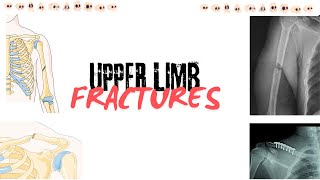 UPPER LIMB FRACTURE DISLOCATIONSCLASSIFICATIONFEATURES AND MANAGMENT shamim dogar orthopedics [upl. by Ner]