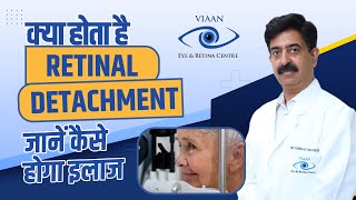 What is Retinal Detachment  Causes and Treatment  Viaan Eye amp Retina Centre [upl. by Htedirem578]