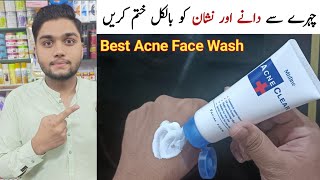 Mistine Acne Clear Face Wash review  pimples removal face wash [upl. by Halie]