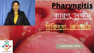 Pharyngitis In Bangla  Causes  Treatments  Home Remedies [upl. by Annekam252]