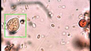 Revision Tp Parasitologie n°31 [upl. by Neiman]