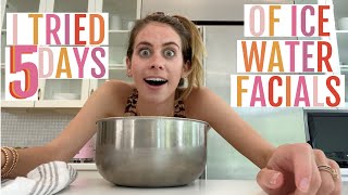 5 Days of Trying Ice Facials Benefits and BeforeAfter  Lucie Fink [upl. by Nosyt]