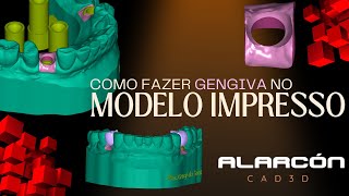 COMO FAZER GENGIVA NO MODELO IMPRESSO fluxodigital exocad [upl. by Mohun923]