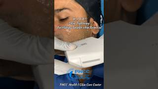 Skin Tightening  Face lifting  Double Chin removal  quotApni umr se 10 saal kam dikhe jawan dikheyquot [upl. by Naujuj337]