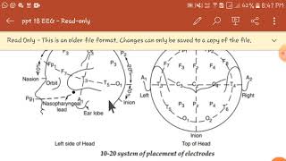 EEG placement of electrodesevoked potential and analysis of EEG signal [upl. by Pincus]