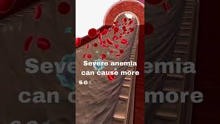 Symptoms of anemia You Need To Know About ANEMIA [upl. by Four]