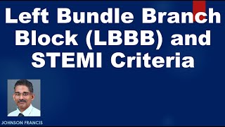 Left Bundle Branch Block LBBB and STEMI Criteria [upl. by Andrus]