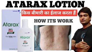 atarax anti itch lotion why doctor is suggesting and how its work and its use [upl. by Andrei]